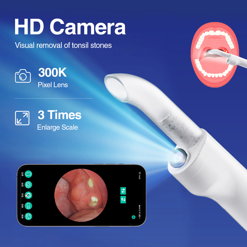 Smart Visual Tonsil Stone Remo - Lighting Visual ulasan dan harga