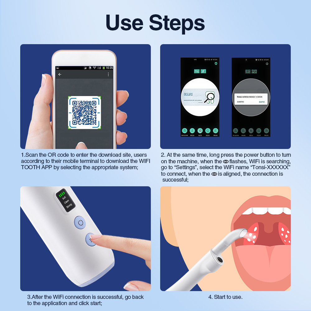 Smart Visual Tonsil Stone Remo - Lighting Visual ulasan dan harga