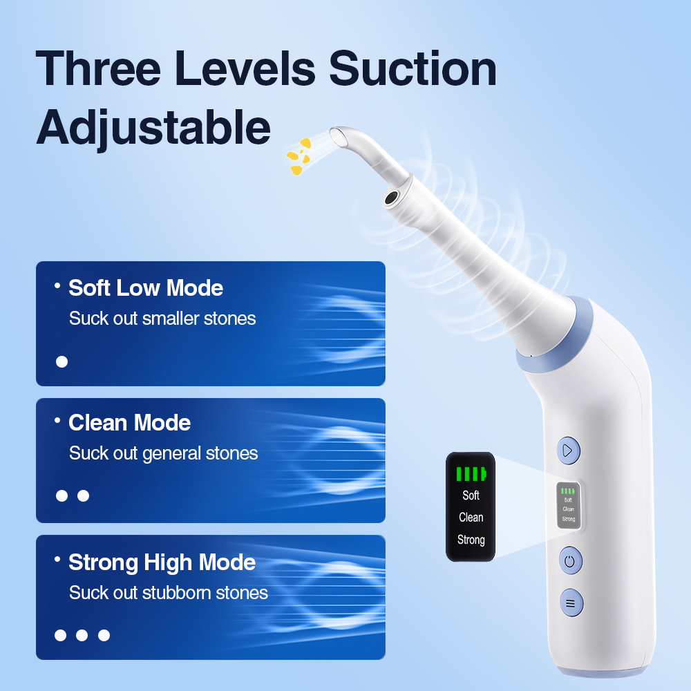 Smart Visual Tonsil Stone Remo - Lighting Visual ulasan dan harga